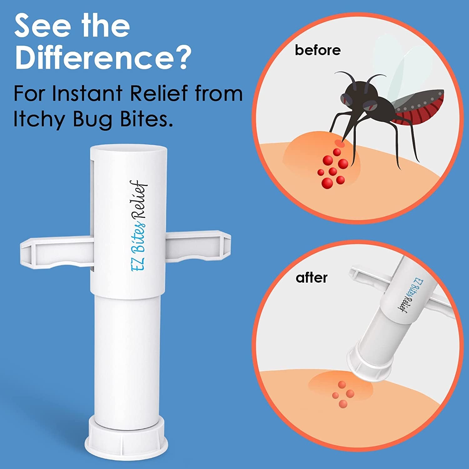Kid-Friendly Bug Bite Suction Tool 3-Pack for Itch Relief and First Aid Outdoors